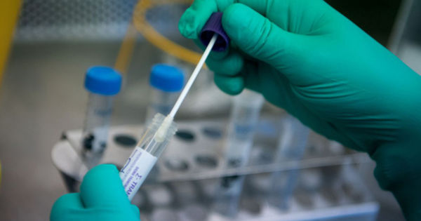 Biến thể virus SARS-CoV-2 JN.1: Một Nhìn Nhận Từ Góc Độ Y Tế