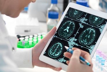 The Intriguing Link Between Early-Onset Dementia and Human Growth Hormone Treatment