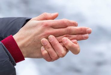 Breakthrough Treatment Approved by FDA for Severe Frostbite