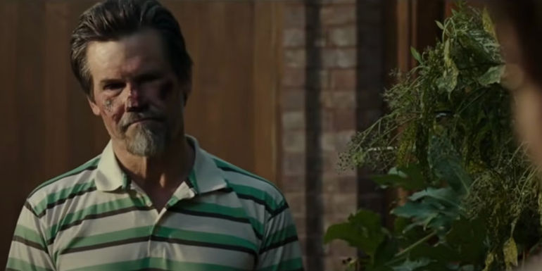 Beck (Josh Brolin) looking at the camera with cuts on his face in Everest