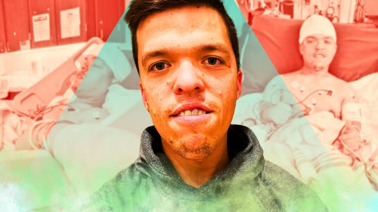 A Tale of Resilience: Zach Roloff's Health Journey on Little People, Big World