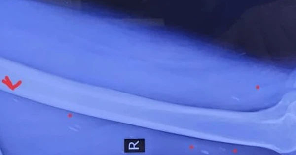 Nguy cơ nhiễm sán dây và cách phòng tránh