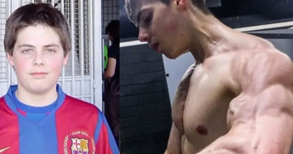 Suy Tim và Nguy Hiểm Của Phương Pháp Giảm Cân Quá Mức