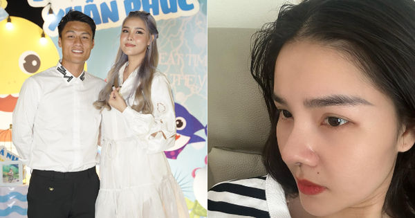 Chuyện "Nâng Mũi" Của Kỳ Hân: Tâm Sự và Chia Sẻ Trước Sự Chê Trách của Dân Tình