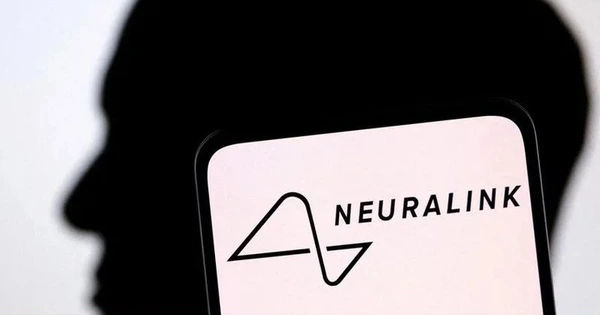 Trải nghiệm độc đáo: Chơi game trên laptop bằng ý nghĩ với chip Neuralink