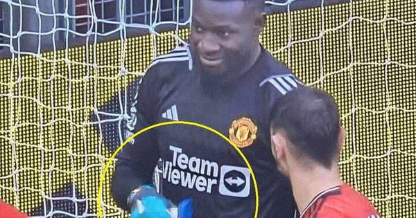 Bí ẩn về kem mà Andre Onana sử dụng trong trận đấu gây sốc với Liverpool