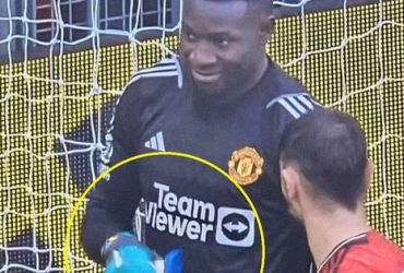 Bí ẩn về kem mà Andre Onana sử dụng trong trận đấu gây sốc với Liverpool