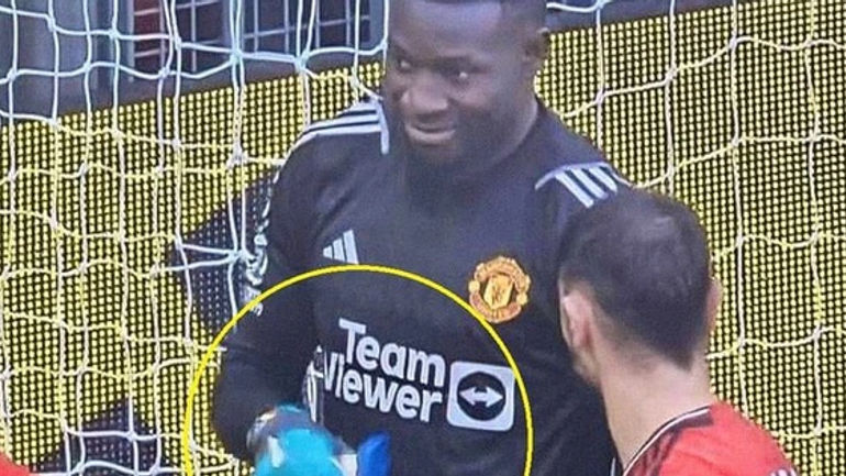 Bí ẩn về kem mà Andre Onana sử dụng trong trận đấu gây sốc với Liverpool