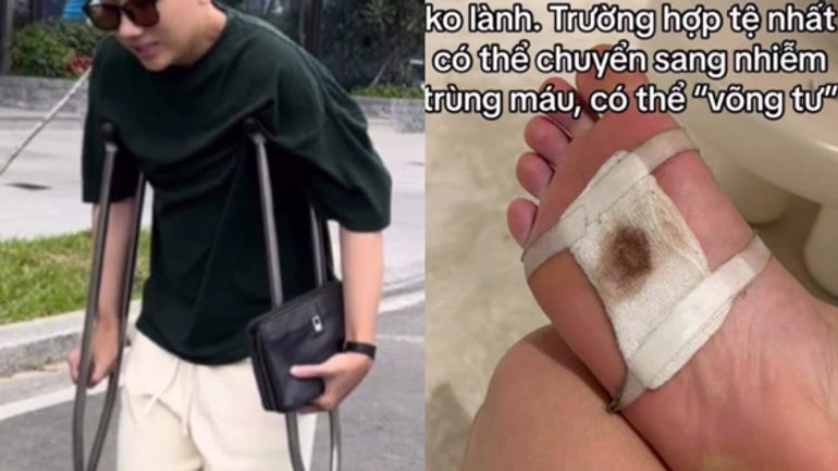 Chân Thương, Hậu Trường Vui Vẻ: Những Khó Khăn và Kỳ Tích Của Dàn Cast Sao Nhập Ngũ
