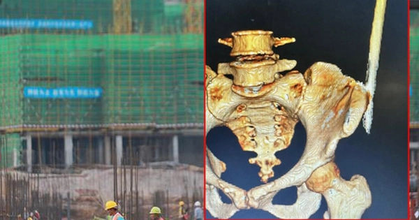 Hành trình kỳ diệu: Nữ công nhân thoát chết sau vụ tai nạn đầy kinh hoàng