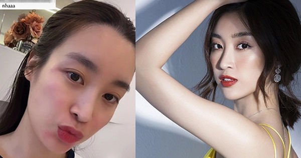 Bí quyết làm đẹp da với tiêm BAP: Phương pháp mới giúp chị em trẻ lâu