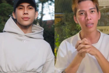 Hành trình đau lòng của chuyên gia trang điểm Lâm Nguyễn: Bài học từ thói quen nguy hiểm