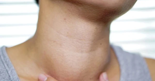 Bướu Tuyến Giáp: Hành Trình Từ Lành Tính Đến Ung Thư