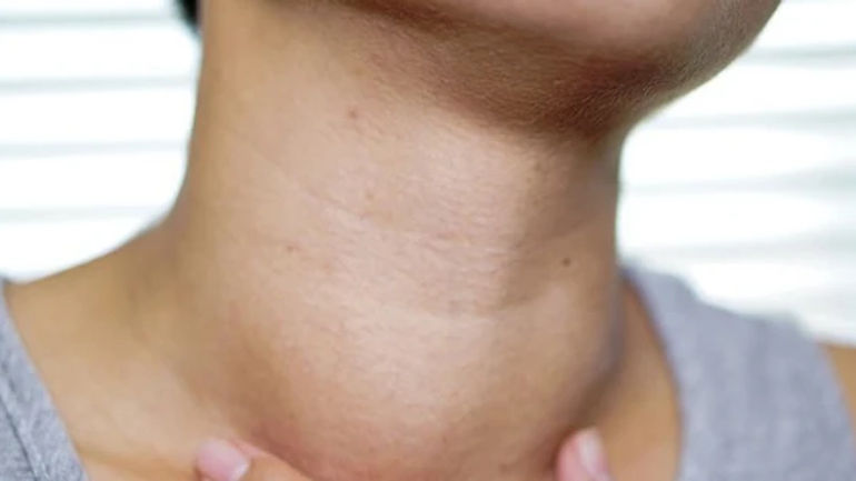 Bướu Tuyến Giáp: Hành Trình Từ Lành Tính Đến Ung Thư