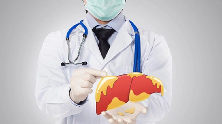 Chuyện Kinh Hoàng từ Việc Uống Nước Ép Mỗi Sáng: Bài Học Đắt Giá về Gan Nhiễm Mỡ