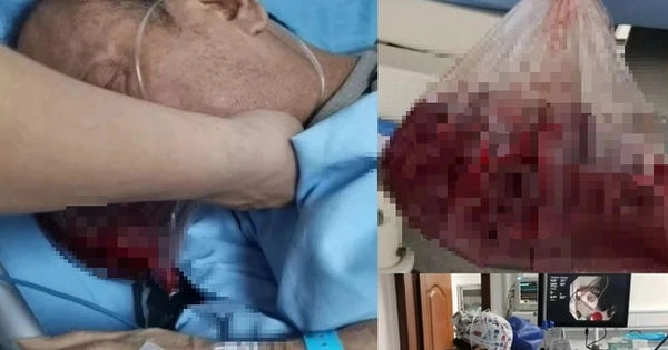 Nam thanh niên mệt mỏi nôn máu liên tục vì thói quen ăn uống gây hại dạ dày