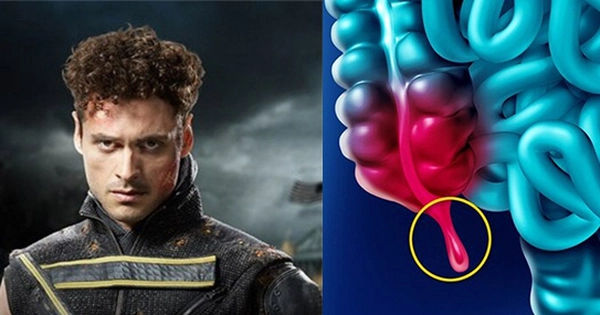 Sao phim X-Men mất mạng vì ung thư ruột thừa ở tuổi 42: Căn bệnh hiếm gặp, khó phát hiện và đang gia tăng