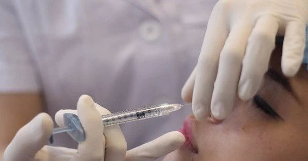 Nguy cơ và biến chứng khi tiêm filler: Cảnh báo từ vụ việc một nữ sinh 17 tuổi gặp biến chứng mù mắt