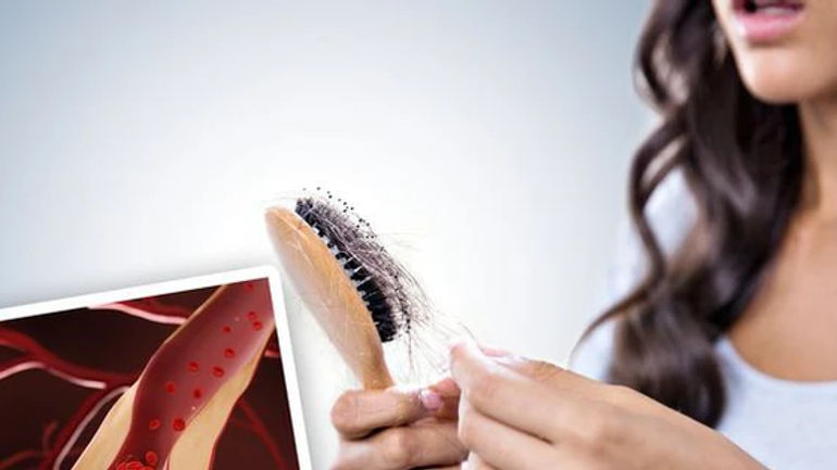 Dấu hiệu sốc trên tóc mà bạn không ngờ đến - cơ hội tiềm ẩn về cholesterol cao