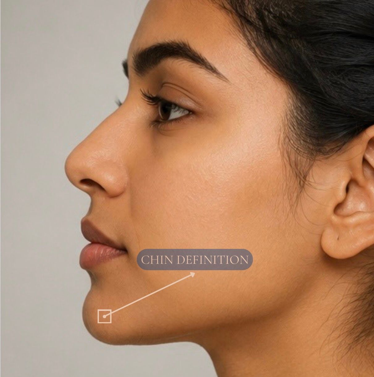 Chin Filler
