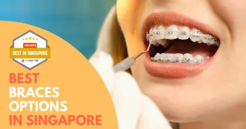 Best Braces Singapore