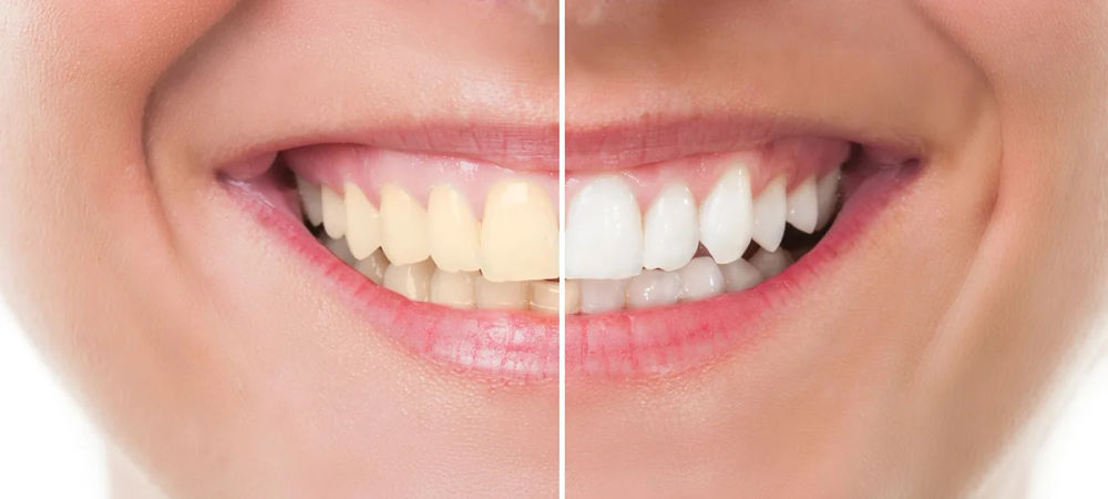 Key characteristics of healthy teeth