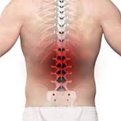 Slipped disc Treatment