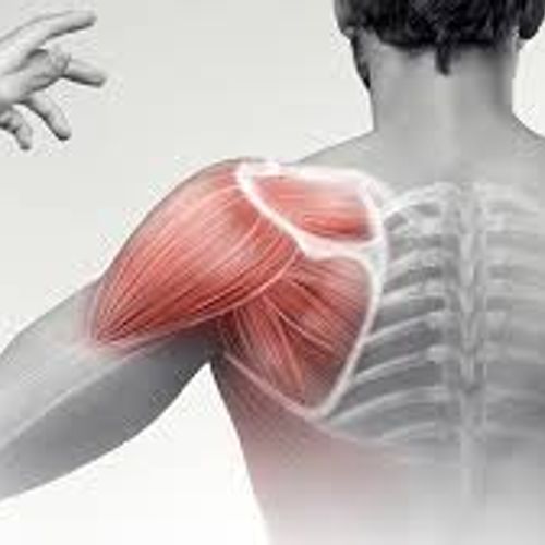 Shoulder Pain Treatment
