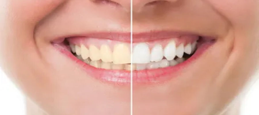 Key characteristics of healthy teeth