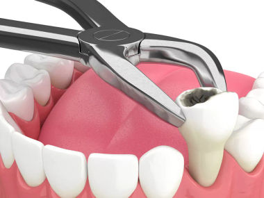 Dental Care Tips