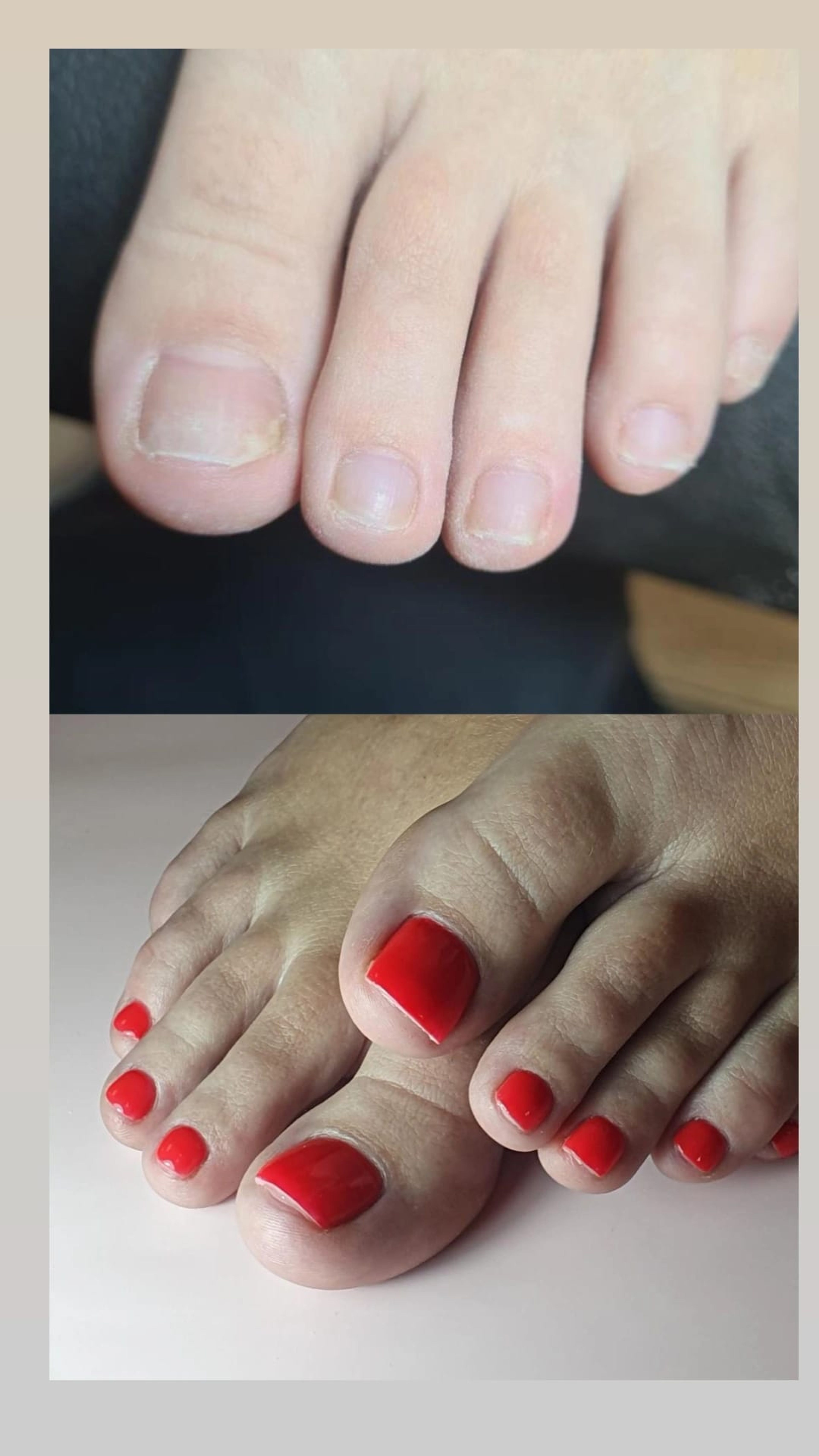 Réparation pieds 