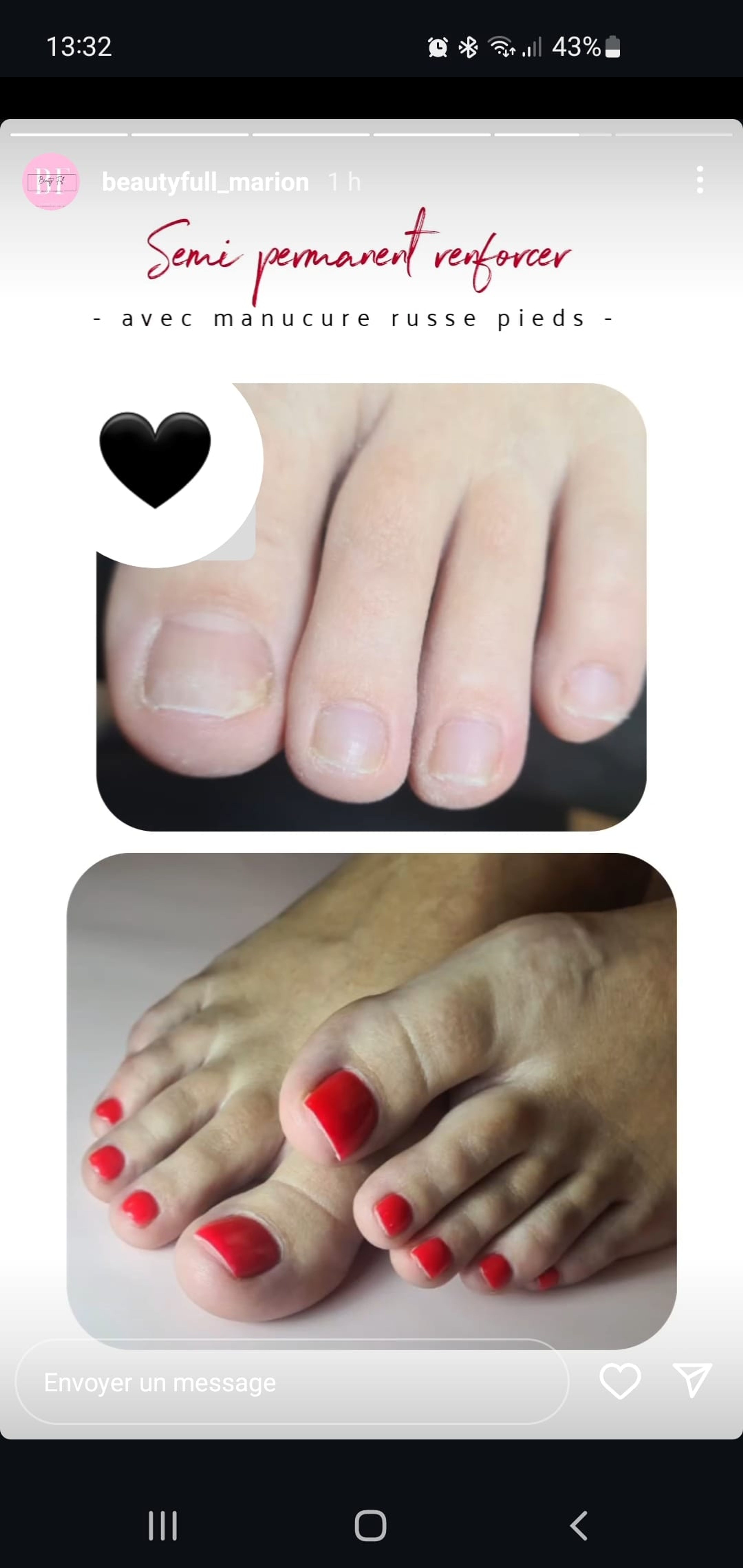 Réparation pieds 