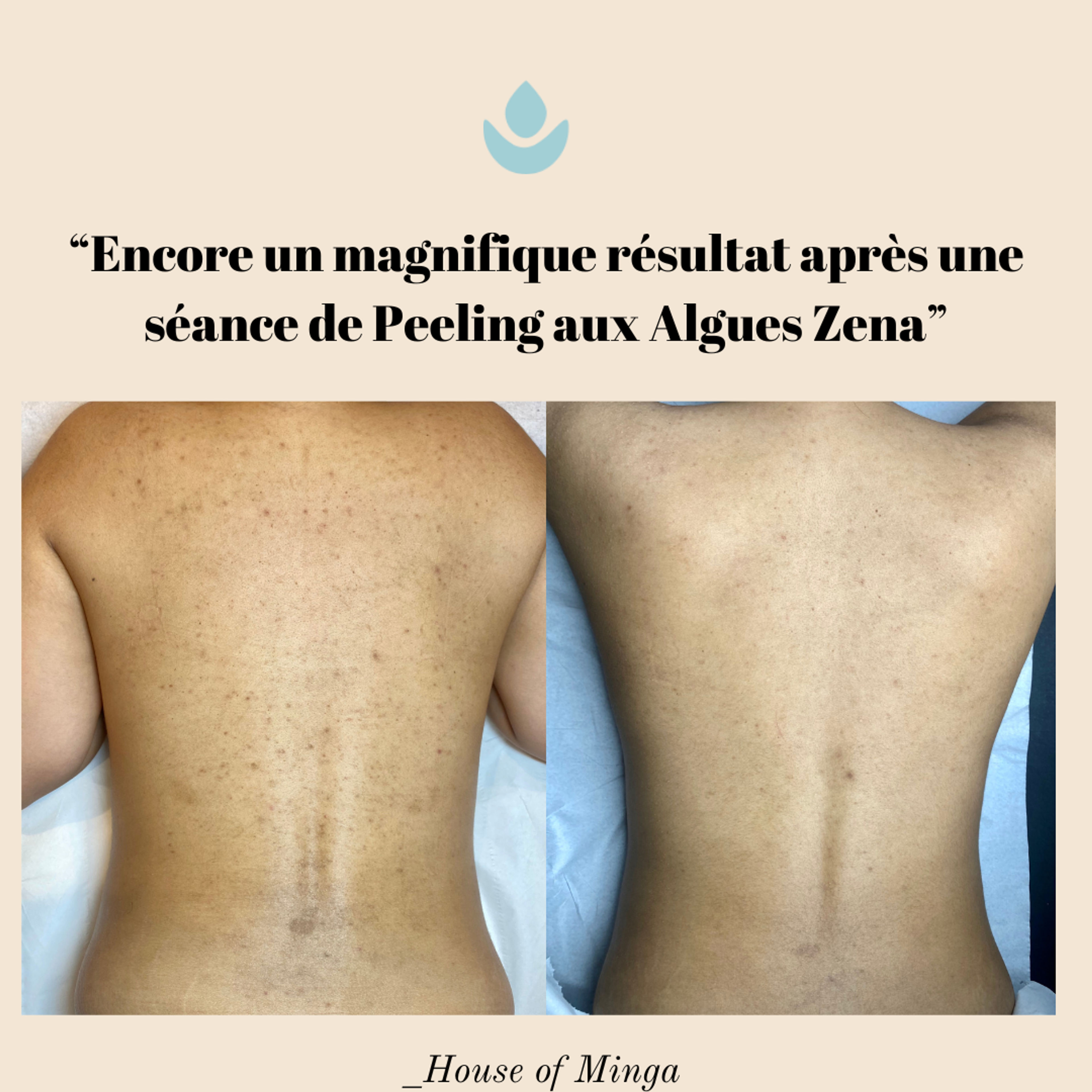 Peeling corps grande zone (dos, ventre, bras…)