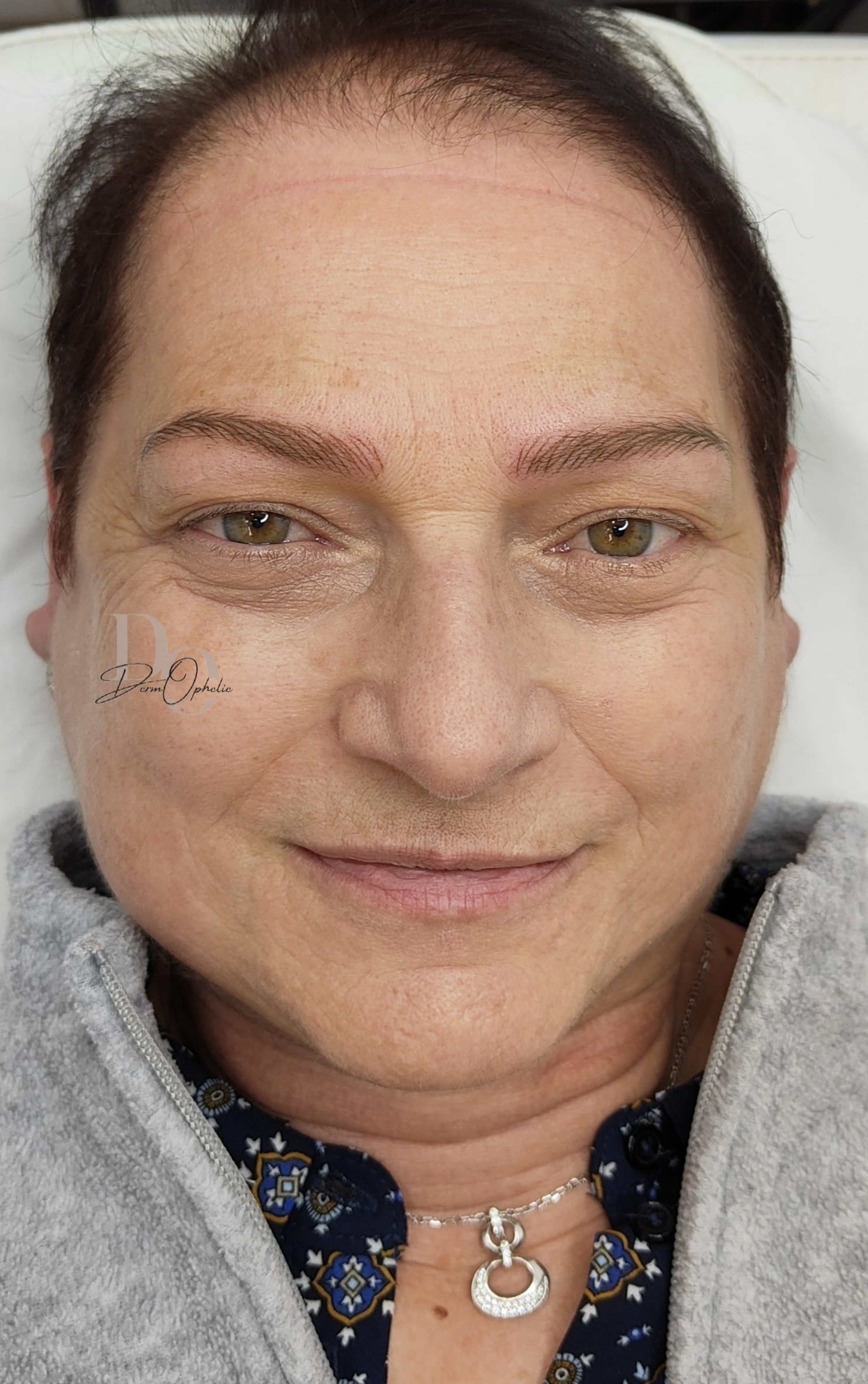 Sourcils poil a poil chimiothérapie 