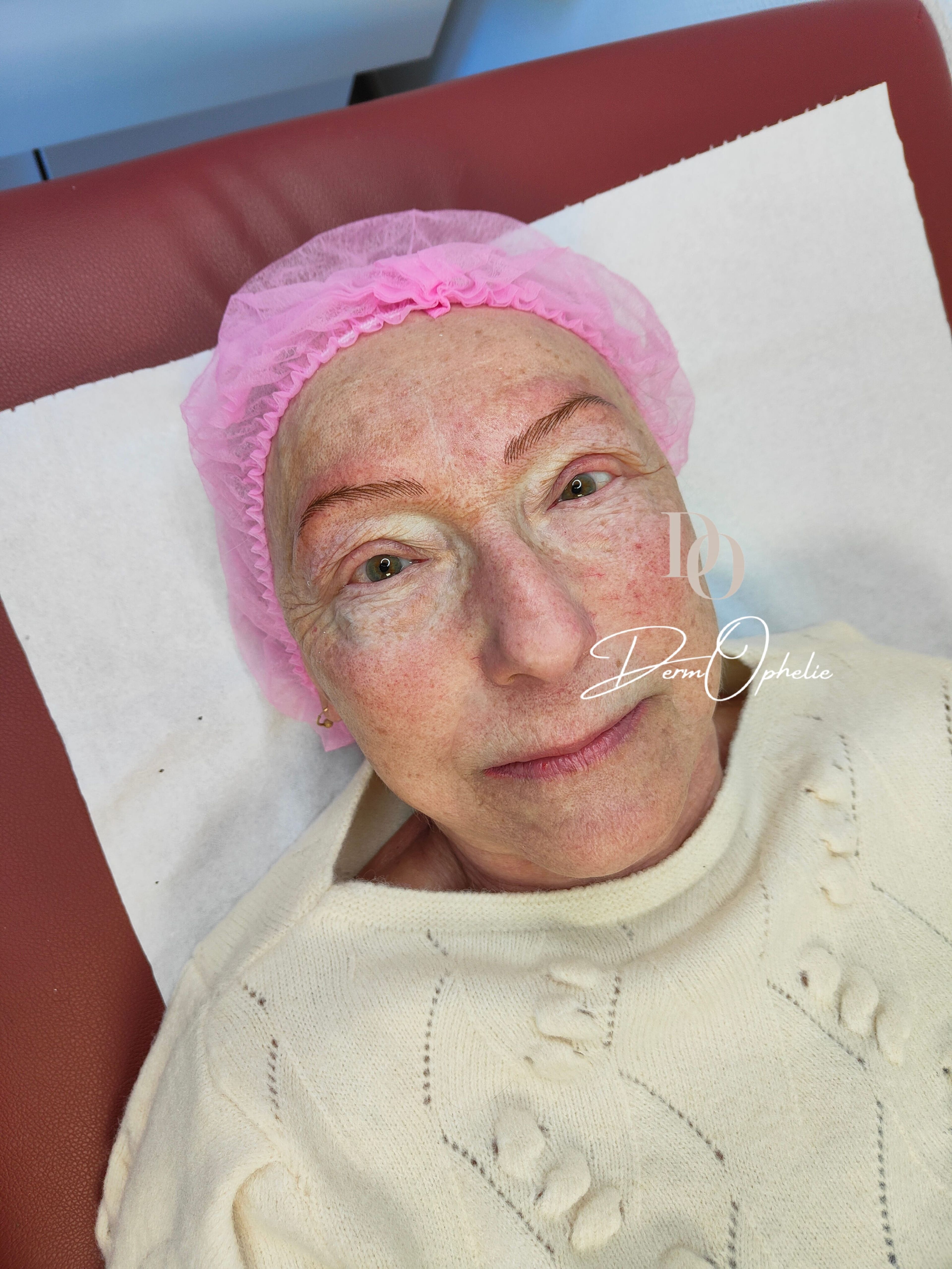Sourcils poil a poil chimiothérapie 