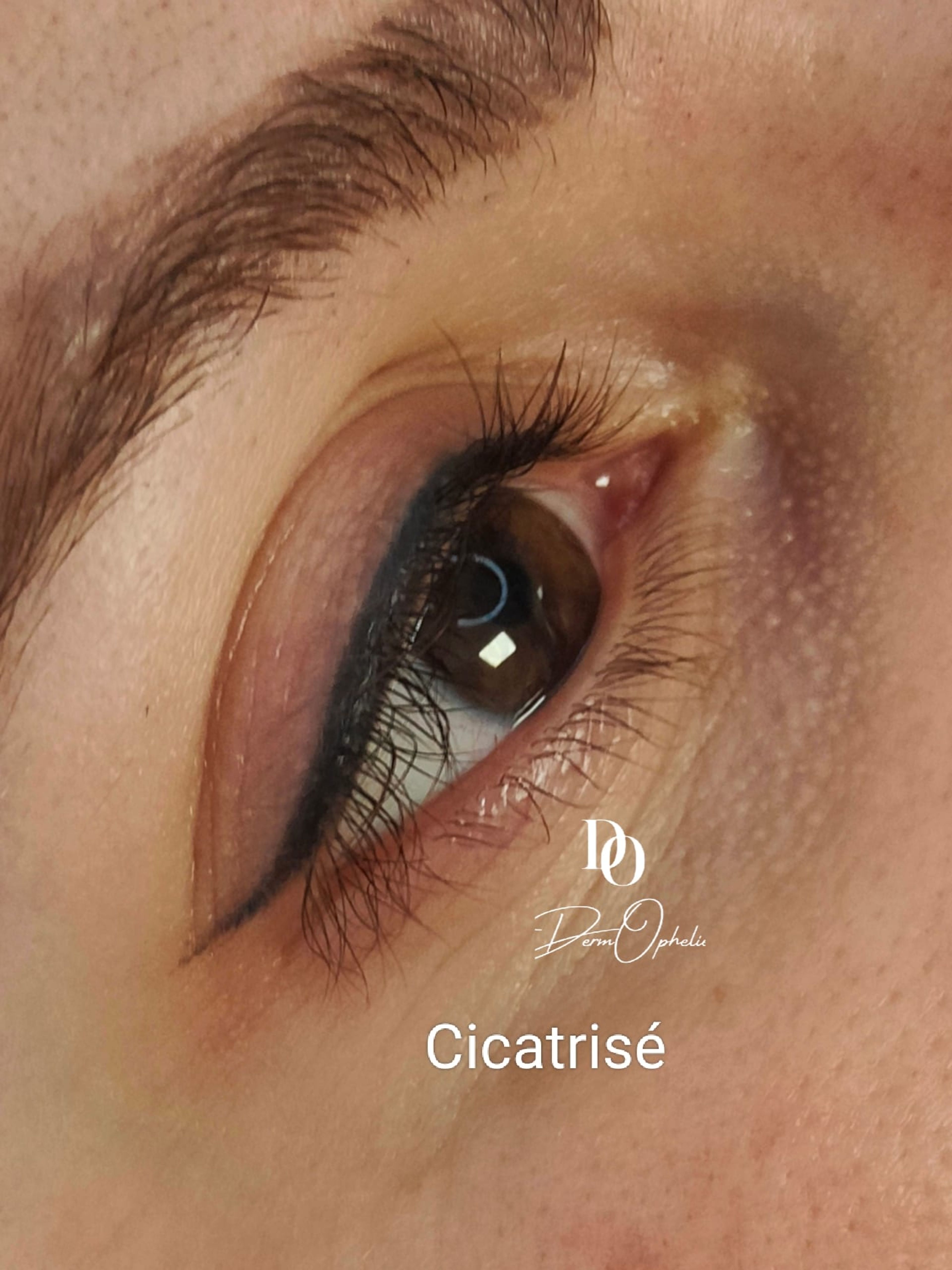 Liner classic 