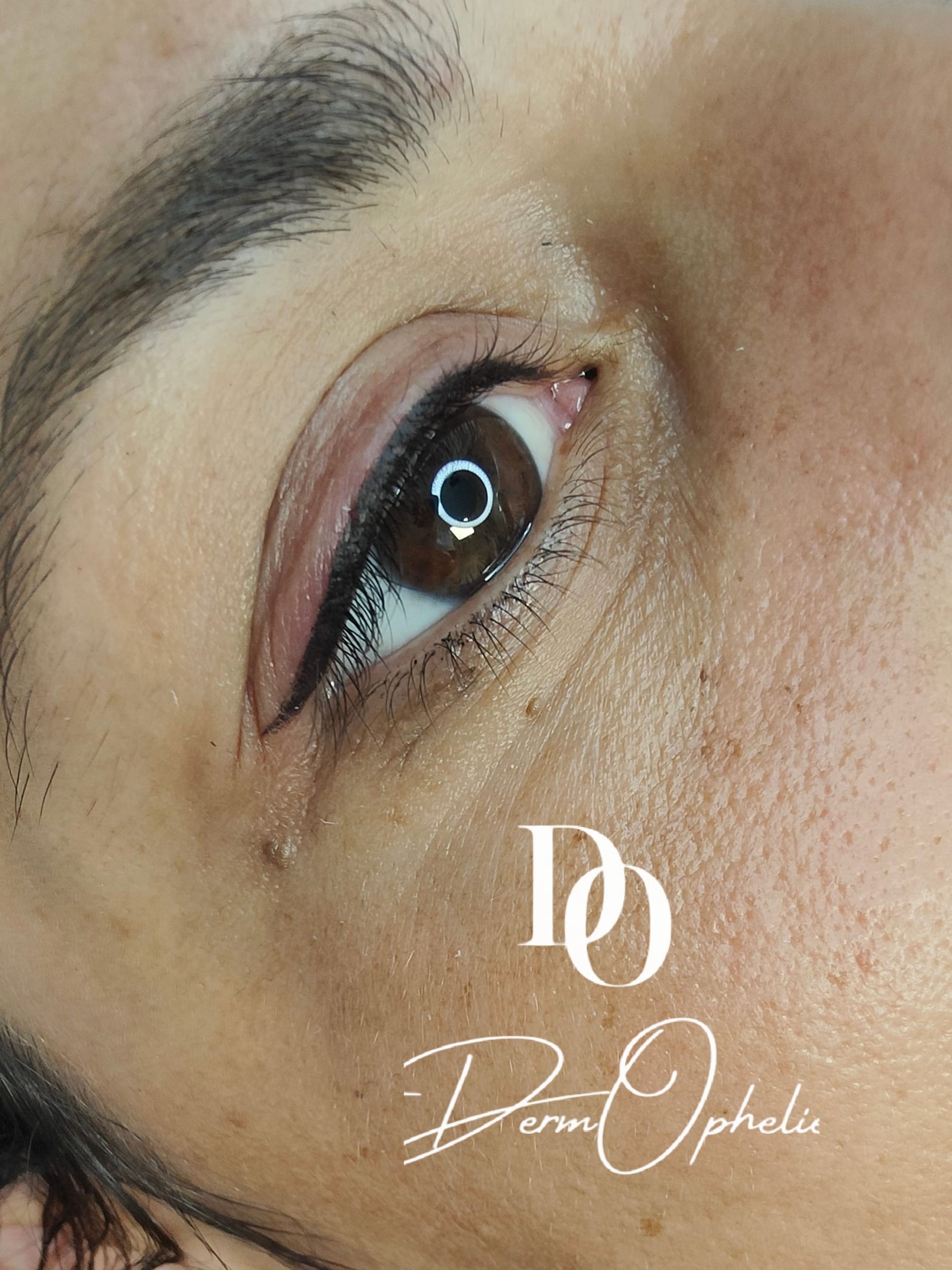 Liner classic 