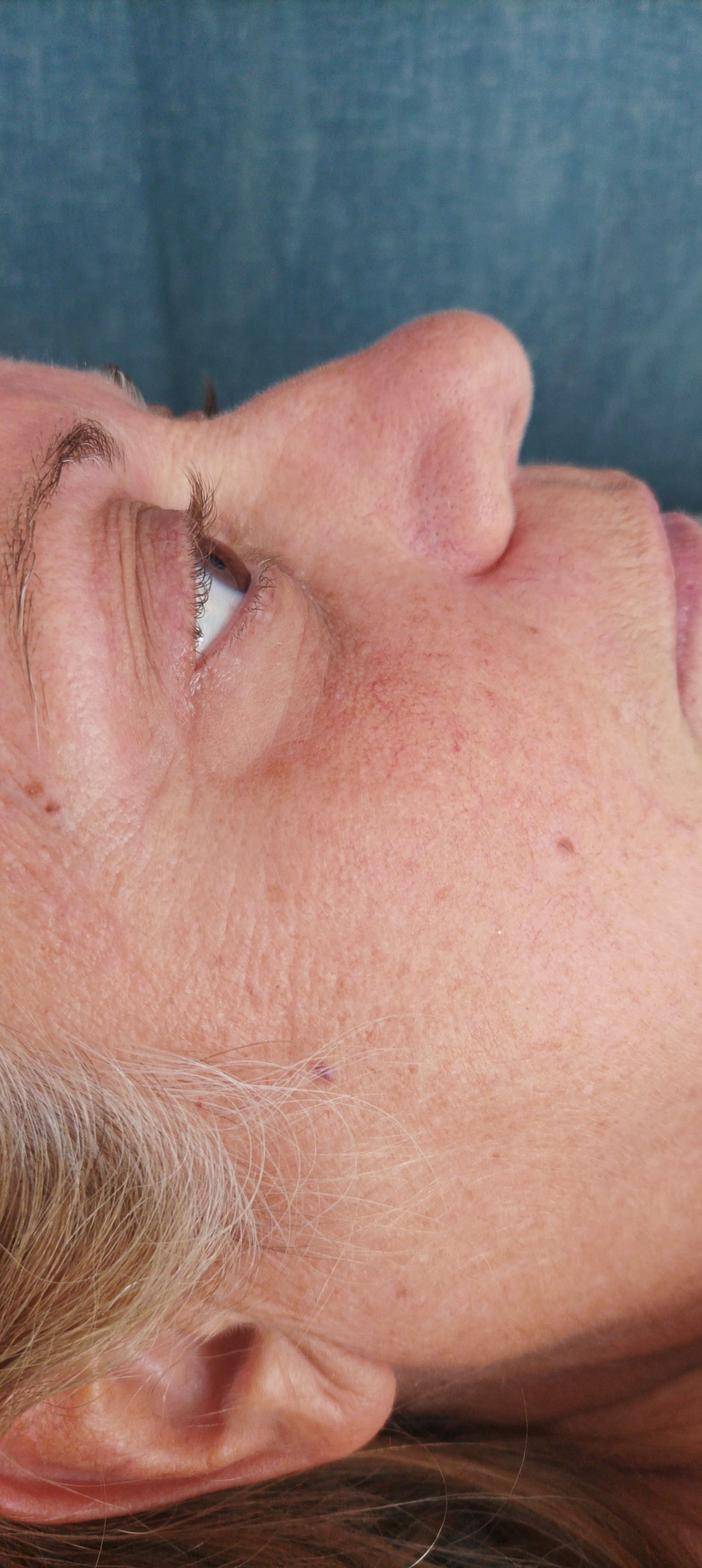 Rehaussement de cils 