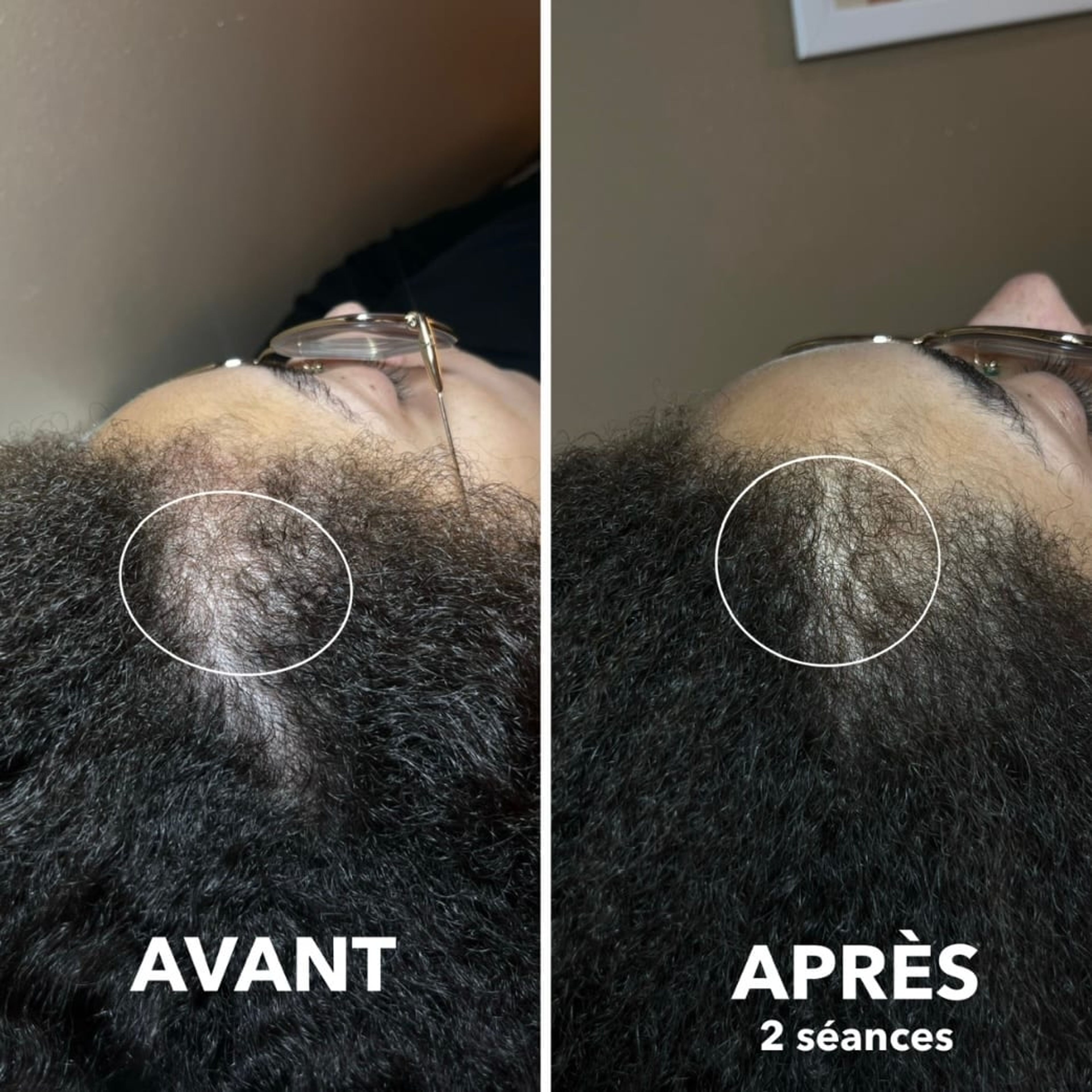 1 séance demi-tête 