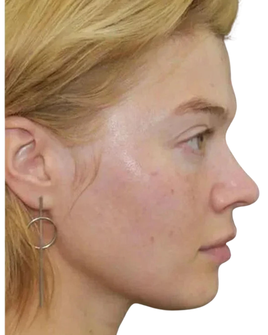 Before treatment