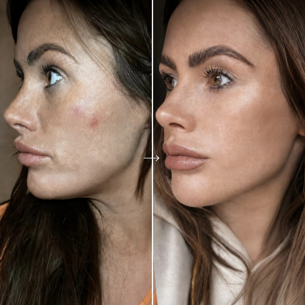 before and after