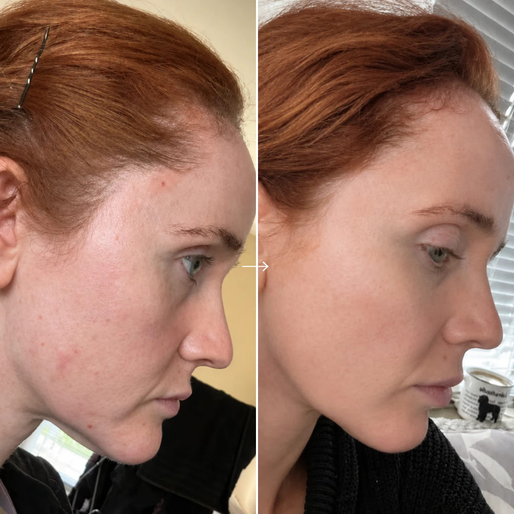 before and after