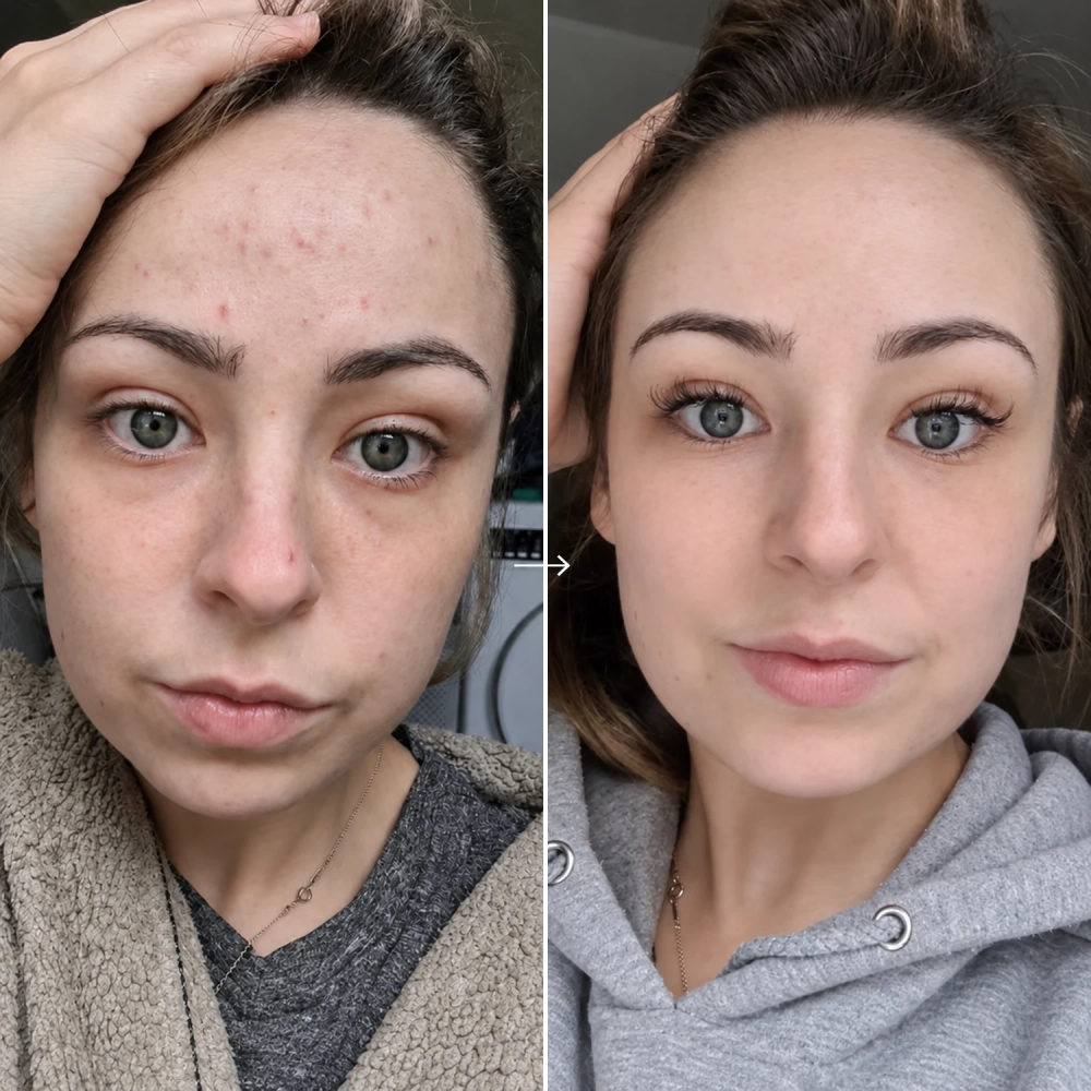 before and after