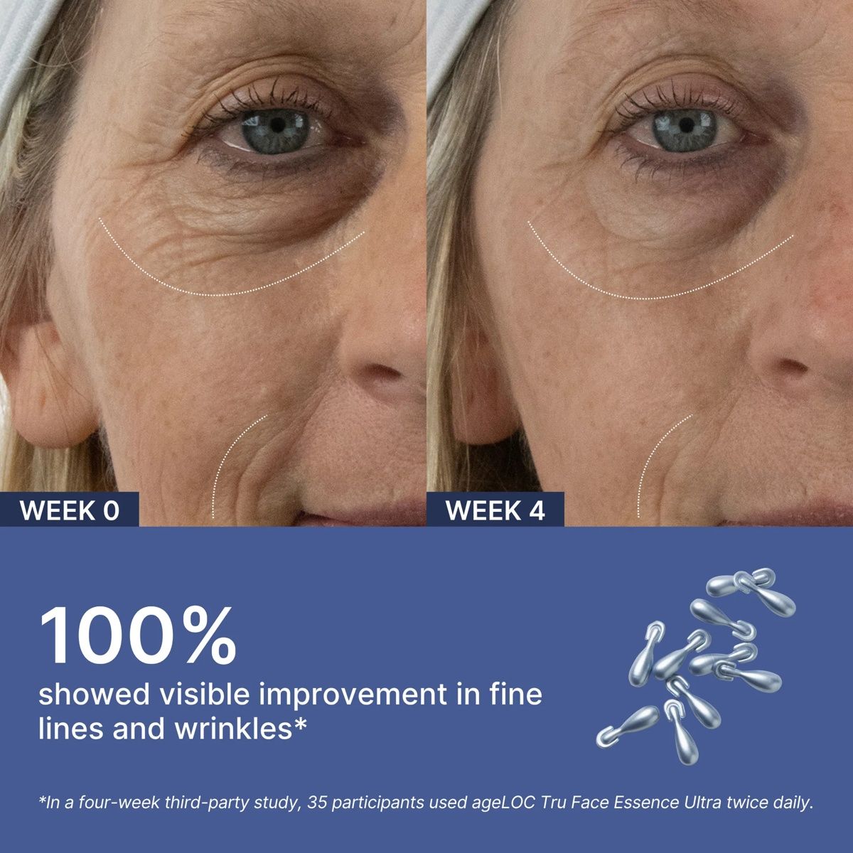 ageLOC® Tru Face® Essence Ultra — view 3