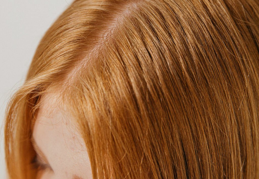 Understanding the Scalp Microbiome