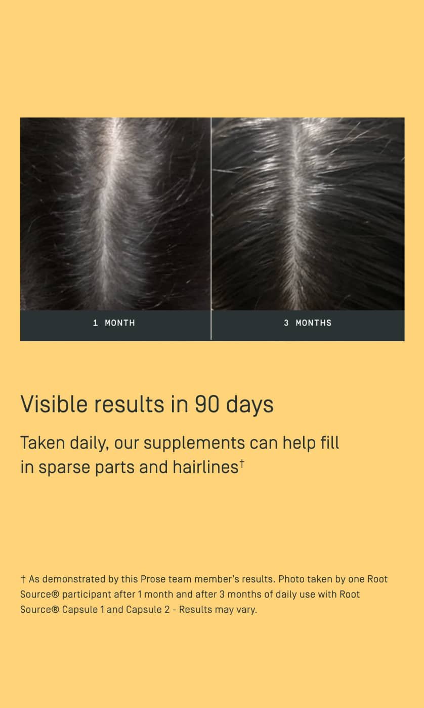 Custom Root Source® Hair Supplements — view 2