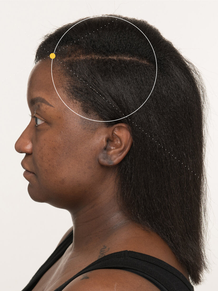 Candace 4 months into taking Nutrafol Postpartum Hair Growth Nutraceutical. Results are from a clinical study and may vary