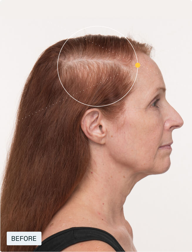 Hair Growth + Equilibrium Duo — view 6