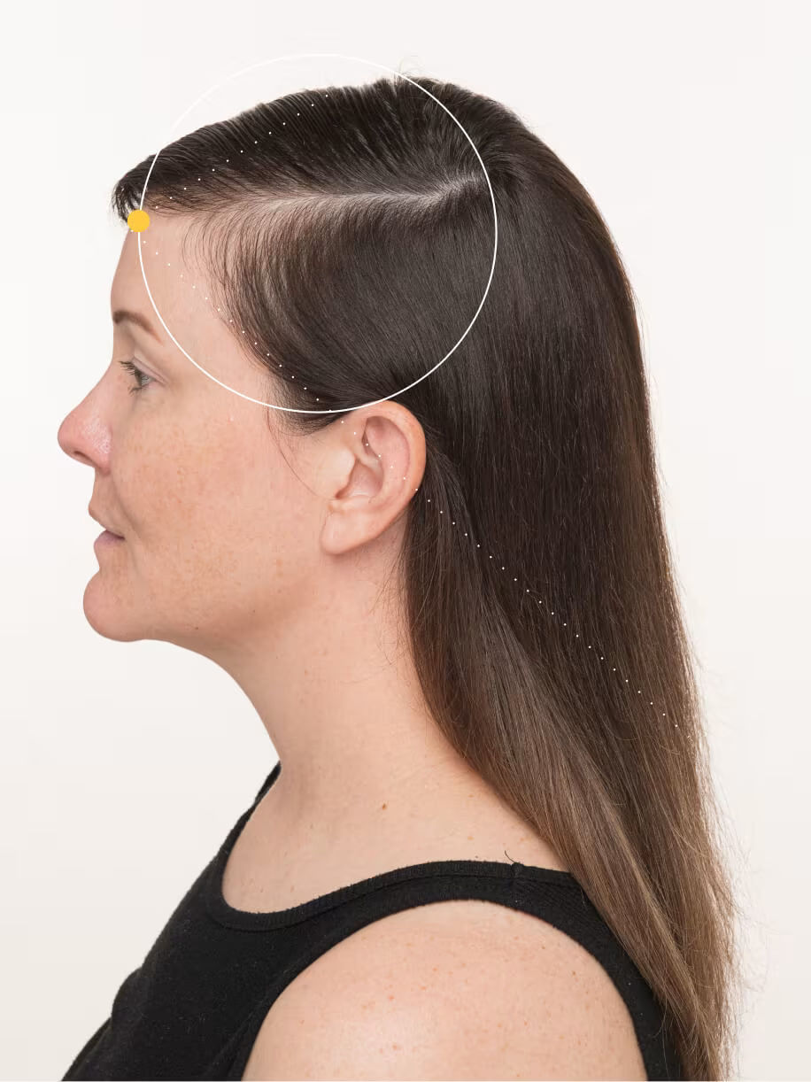 Lindsey before taking Nutrafol Women Hair Growth Nutraceutical.