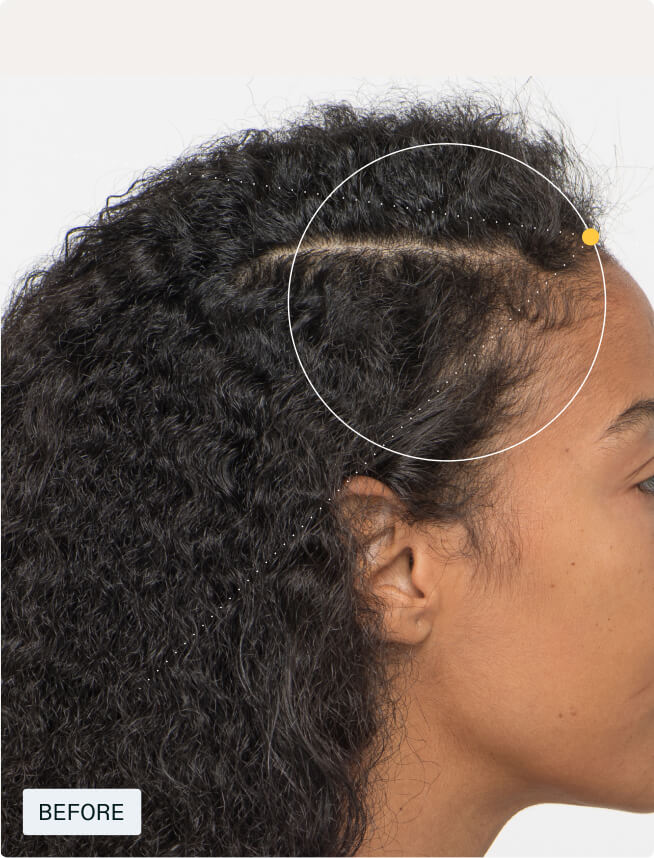 Hair Growth + Longevity Duo — view 6